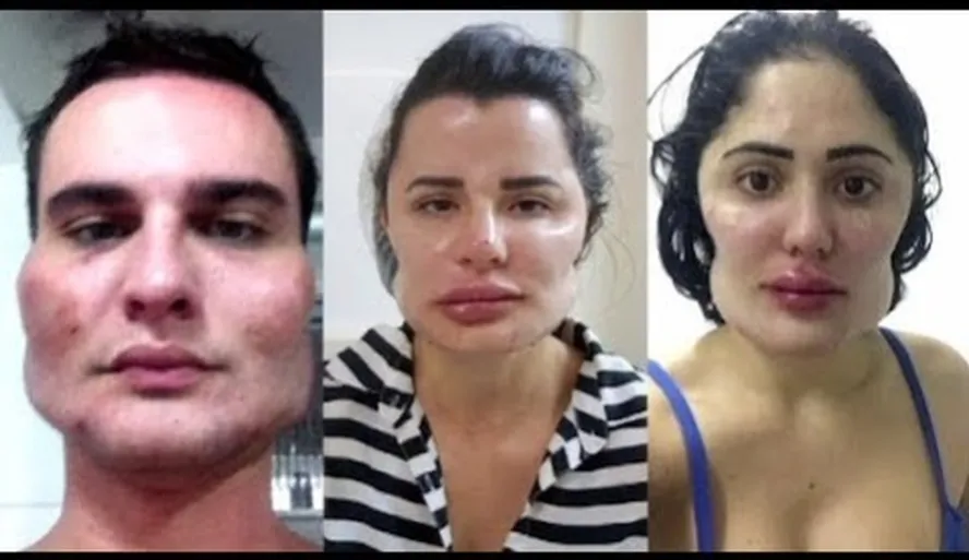 Médico é condenado à prisão após deformar o rosto de pelo menos nove pacientes