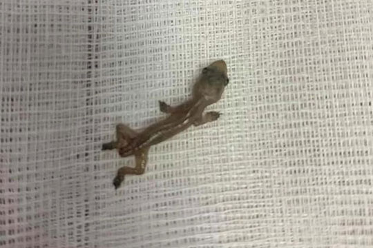 Menino é internado em estado grave após madrasta obrigá-lo a comer lagartixa