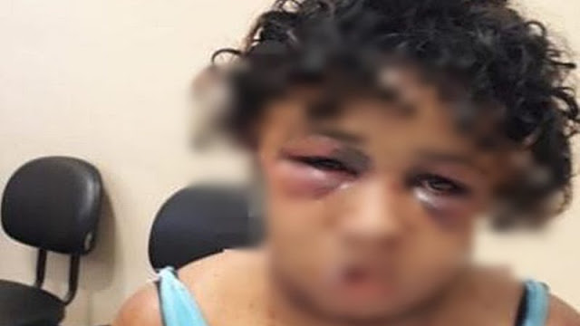 Homem espanca esposa por quatro horas e queima rosto da vítima com maçarico