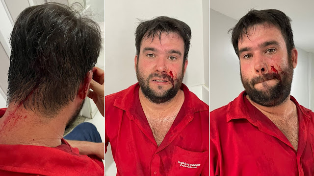 Farmacêutico é agredido por companheiro de sua irmã, por causa de herança da família