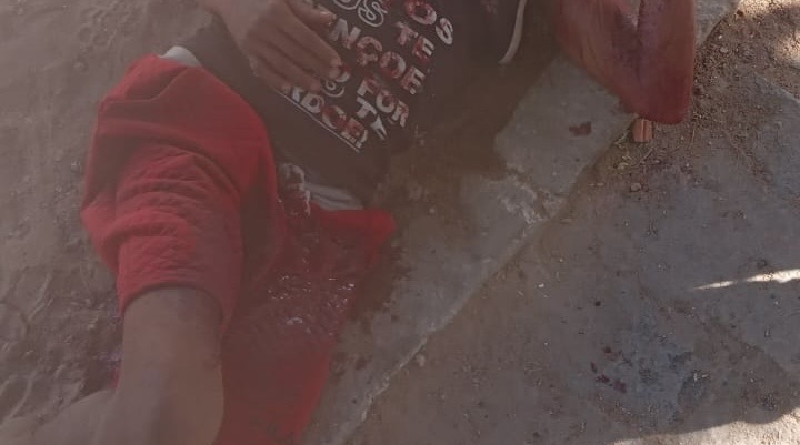 Homem é internado após sofrer pedradas na cabeça, em Queimadas