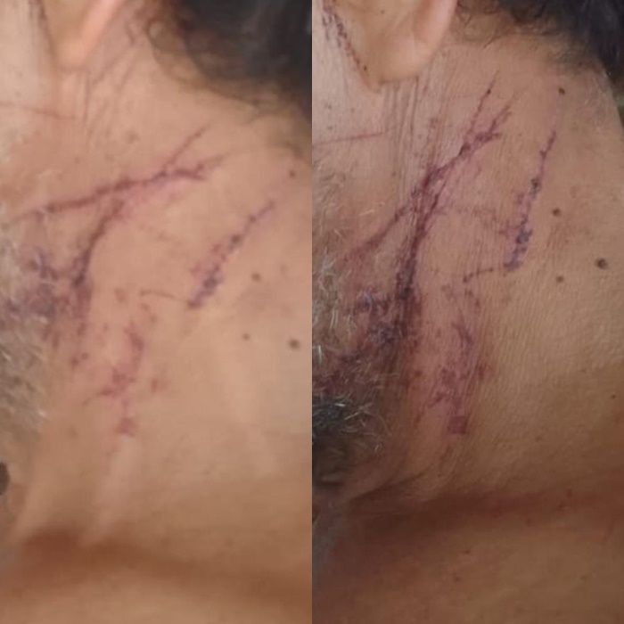 Briga dentro de carro motivou morte de lavrador em Nordestina, diz defesa